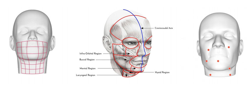 The electrode points where neuromuscular signals are strong enough to picked up by AI.