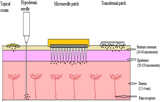 As the microneedle patches don't reach upto the pain-receptors; they are far more better than ordinary needles 